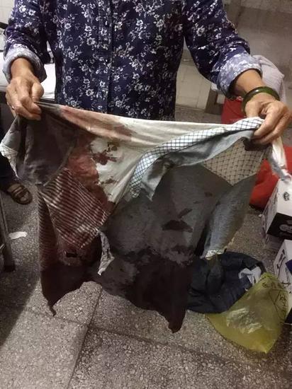 一位伤者的衣服上沾满血迹 图 |王朋朋